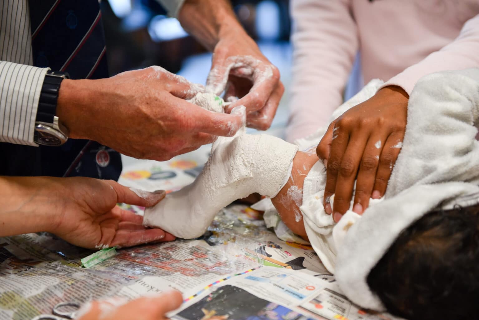Clubfoot treatment - Steps | Clubfoot support in Southern Africa